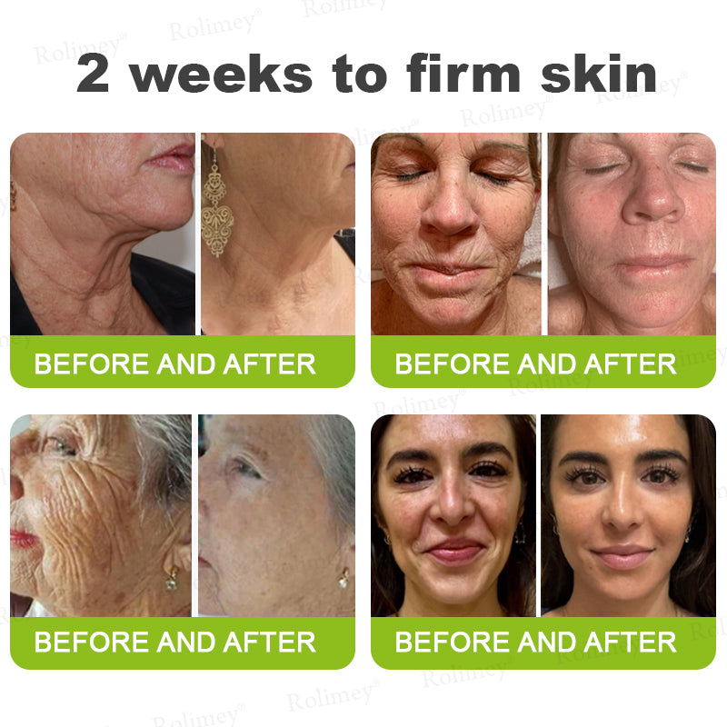 ❤️ ✨Made and shipped from Australia 💫Rolimey® Botox & Vita-A Retinol Shot Wrinkle-Lift Tightening cream - Last Day Promotion 50% OFF