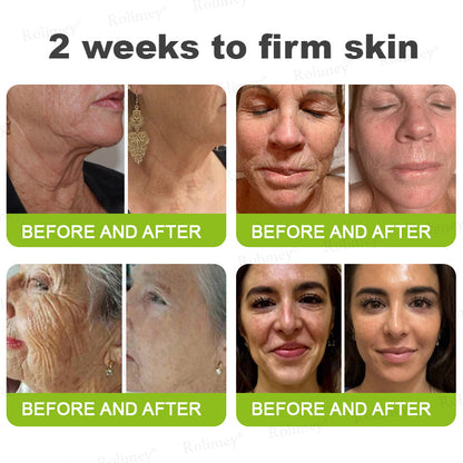 ❤️ ✨Made and shipped from Australia 💫Rolimey® Botox & Vita-A Retinol Shot Wrinkle-Lift Tightening cream - Last Day Promotion 50% OFF