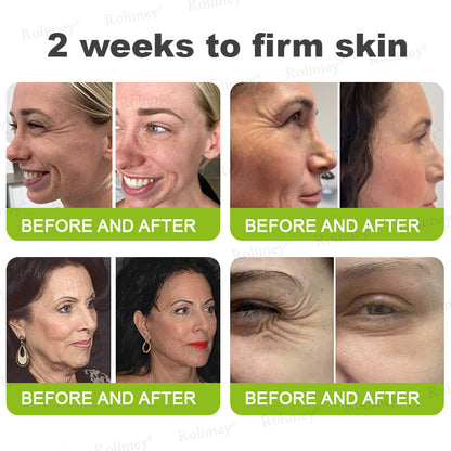 ❤️ ✨Made and shipped from Australia 💫Rolimey® Botox & Vita-A Retinol Shot Wrinkle-Lift Tightening cream - Last Day Promotion 50% OFF