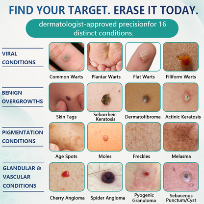🇦🇺✨🌿Celsiora® 7 Day Wart & Skin Tag Remover Foam (Targeted Solution for Warts, Skin Tags & Uneven Skin Texture)