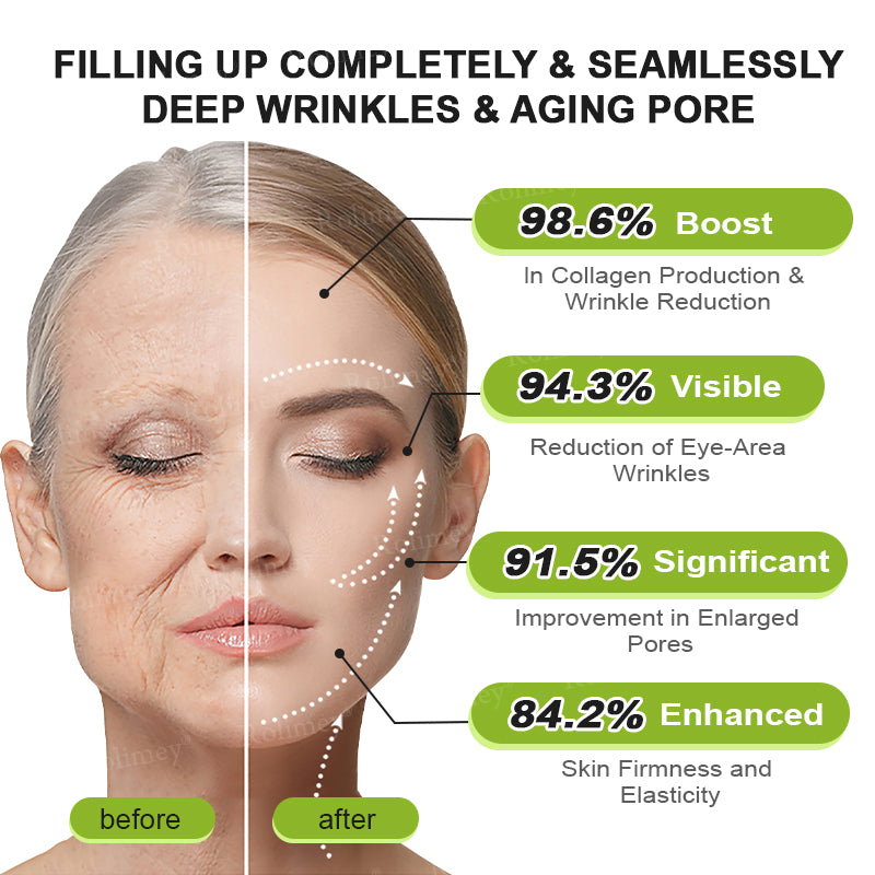 ❤️ ✨Made and shipped from Australia 💫Rolimey® Botox & Vita-A Retinol Shot Wrinkle-Lift Tightening cream - Last Day Promotion 50% OFF