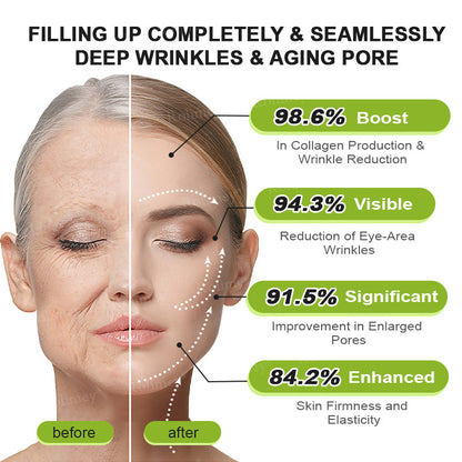 ❤️ ✨Made and shipped from Australia 💫Rolimey® Botox & Vita-A Retinol Shot Wrinkle-Lift Tightening cream - Last Day Promotion 50% OFF