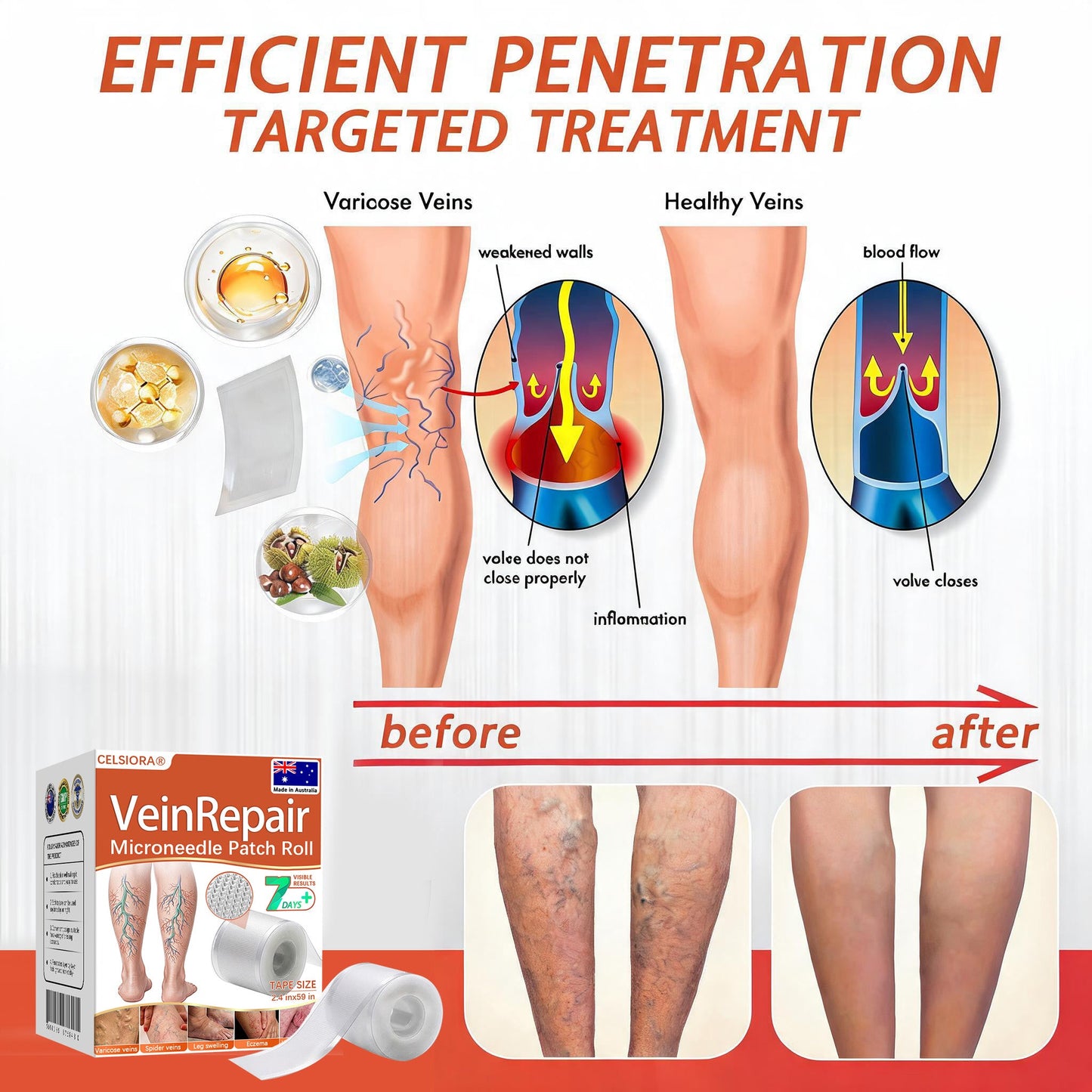 🌟🌿Official AU Store 🇦🇺 | Celsiora® Vein Ease Microneedle Care Patch(For Spider Veins, Varicose Veins, Swelling & Leg Fatigue) - Last Day Promotion 50% OFF