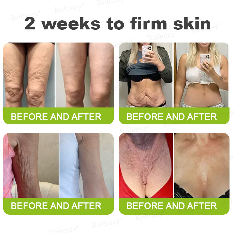 ❤️ ✨Made and shipped from Australia 💫Rolimey® Botox & Vita-A Retinol Shot Wrinkle-Lift Tightening cream - Last Day Promotion 50% OFF