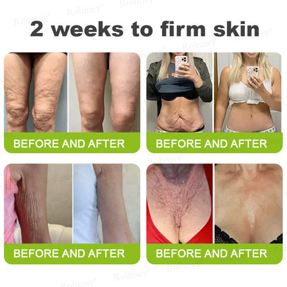 ❤️ ✨Made and shipped from Australia 💫Rolimey® Botox & Vita-A Retinol Shot Wrinkle-Lift Tightening cream - Last Day Promotion 50% OFF