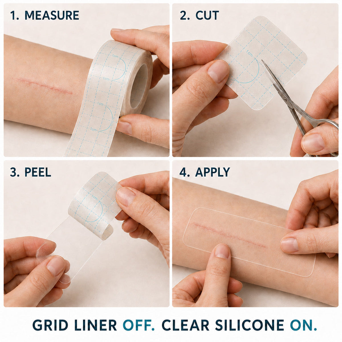 🇦🇺🎁🧚TRILUMIA® SILICONE SCAR THERAPY ROLL Help Soften, Flatten & Improve the Appearance of Raised Scars