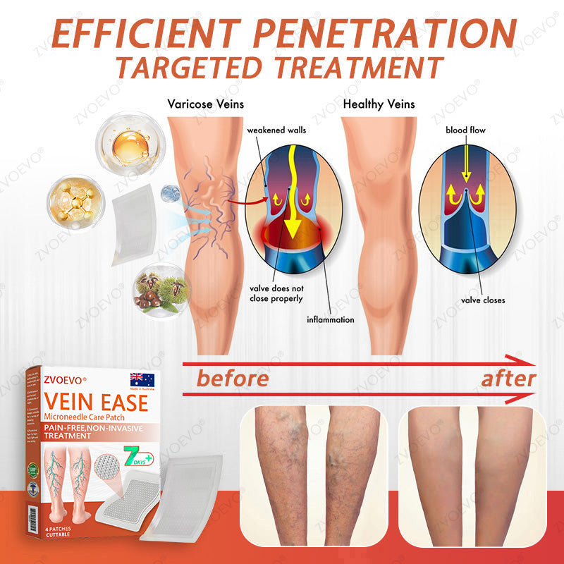 👨‍⚕️🌿Zvoevo® Vein Ease Microneedle Care Patch(For Spider Veins, Varicose Veins, Swelling & Leg Fatigue) - Last Day Promotion 50% OFF