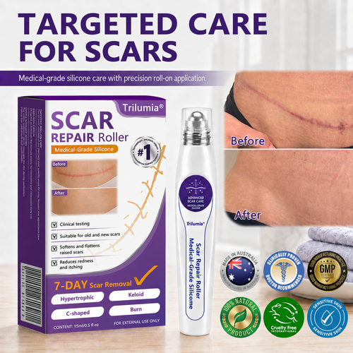🇦🇺👨‍⚕️Trilumia® Medical-Grade Silicone Scar Repair Roller (For Raised, Red, Firm, Tight & Discoloured Surgical Scars)