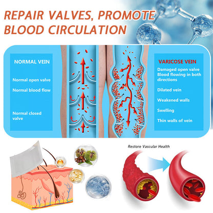 🌟🌿Official AU Store 🇦🇺 | Celsiora® Vein Ease Microneedle Care Patch(For Spider Veins, Varicose Veins, Swelling & Leg Fatigue) - Last Day Promotion 50% OFF