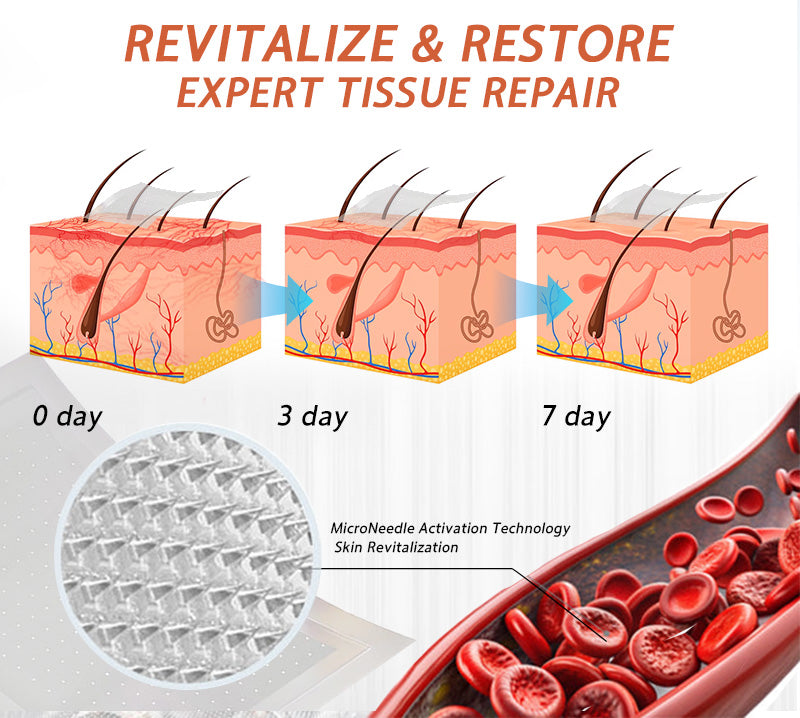 🌟🌿Official AU Store 🇦🇺 | Celsiora® Vein Ease Microneedle Care Patch(For Spider Veins, Varicose Veins, Swelling & Leg Fatigue) - Last Day Promotion 50% OFF