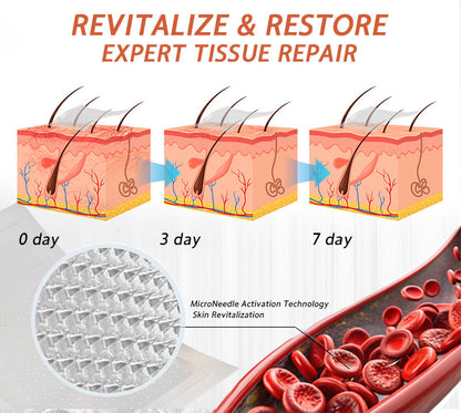 🌟🌿Official AU Store 🇦🇺 | Celsiora® Vein Ease Microneedle Care Patch(For Spider Veins, Varicose Veins, Swelling & Leg Fatigue) - Last Day Promotion 50% OFF
